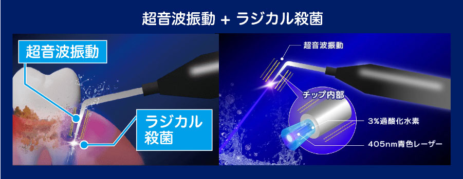 ブルーラジカル
